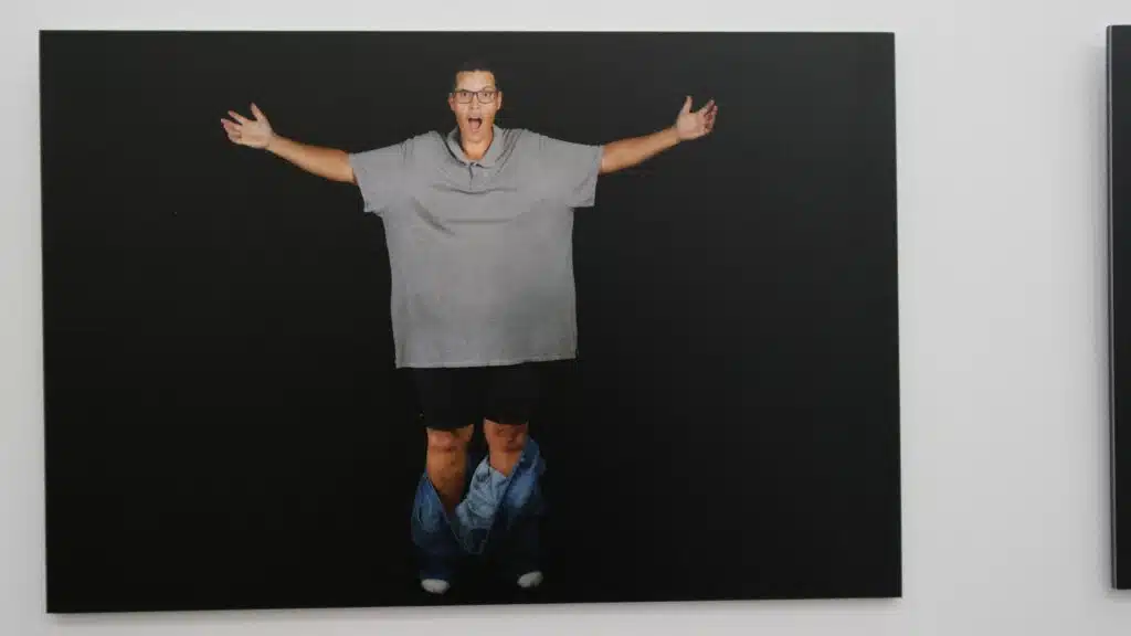 Brice expo photo Apprivoise obésité Marie Manecy CHU